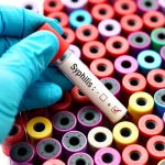 Penyakit Sifilis – Gejala, Pengobatan, dan Data Kasus Sifilis di Indonesia